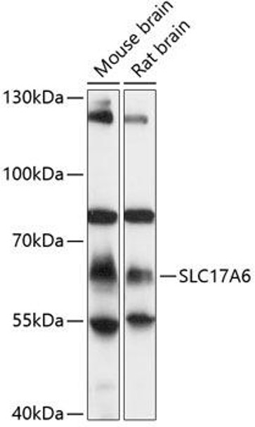Anti-SLC17A6 Antibody (CAB13648)