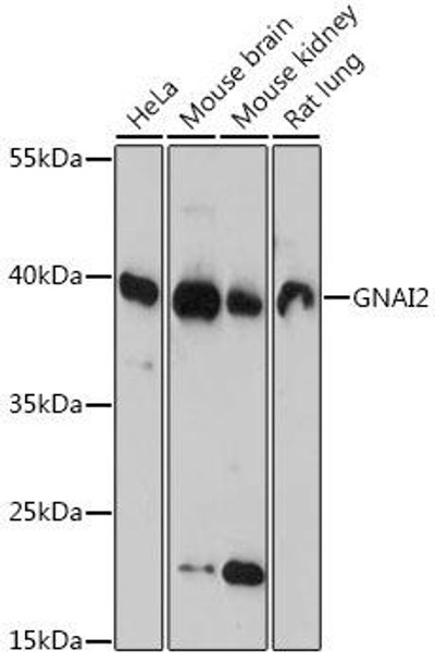 Anti-GNAI2 Antibody (CAB14547)