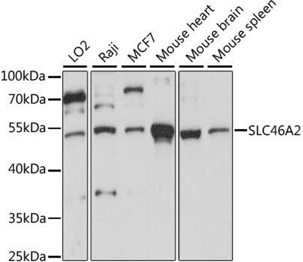 Anti-SLC46A2 Antibody (CAB15494)