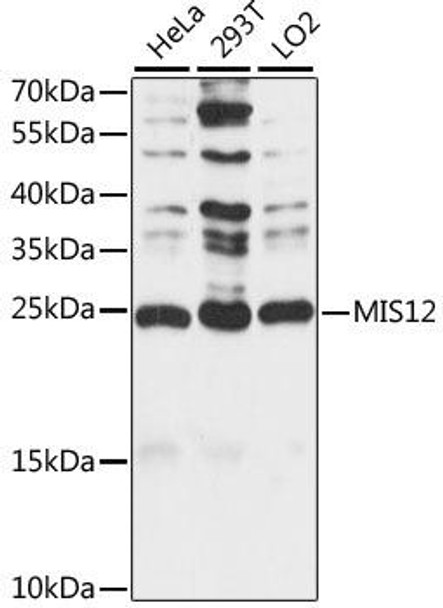 Anti-MIS12 Antibody (CAB15508)