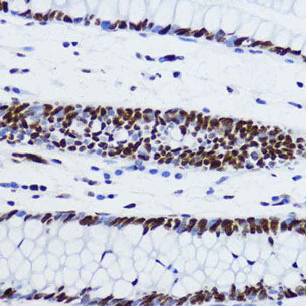 Anti-Acetyl-Histone H2B-K12 Antibody (CAB15619)