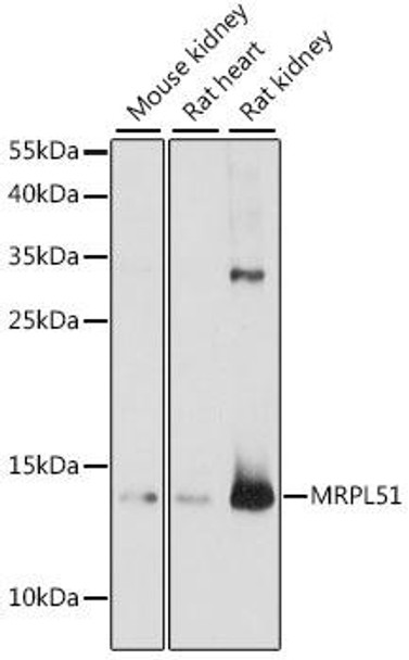 Anti-MRPL51 Antibody (CAB15838)