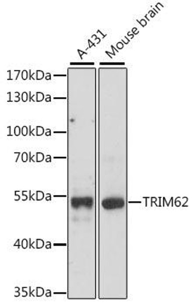 Anti-TRIM62 Antibody (CAB15855)