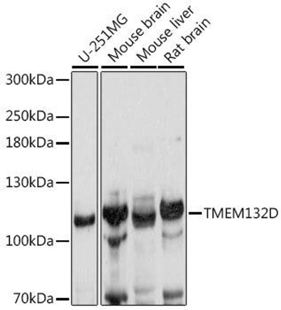 Anti-TMEM132D Antibody (CAB16164)