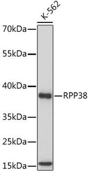 Anti-RPP38 Antibody (CAB17080)