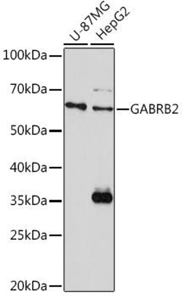 Anti-GABRB2 Antibody (CAB1876)