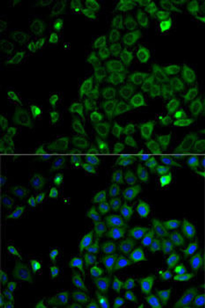 Anti-MSR1 Antibody (CAB1923)