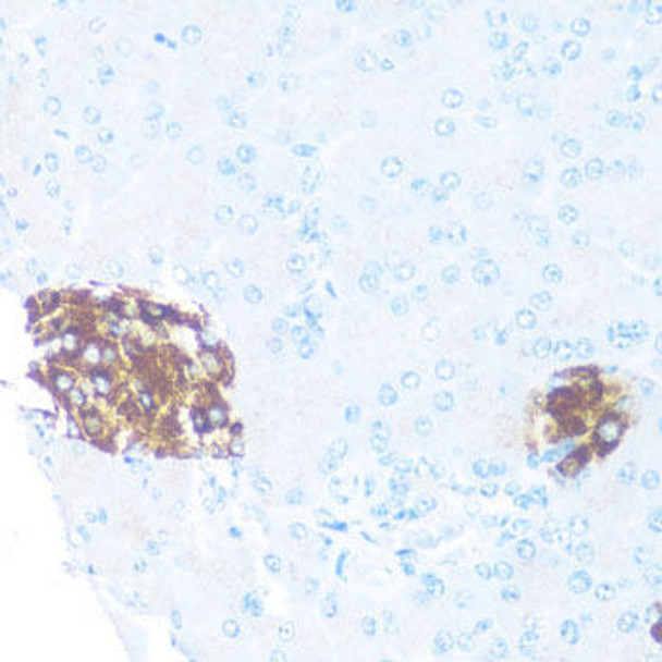 Anti-ODC1 Antibody (CAB1948)