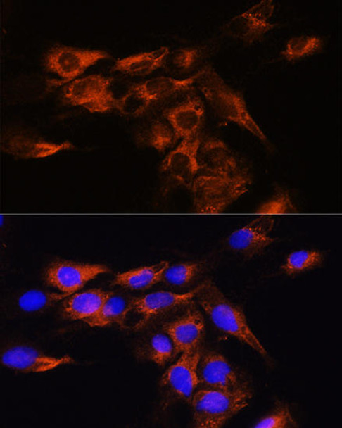 Anti-ADORA2B Antibody (CAB1953)