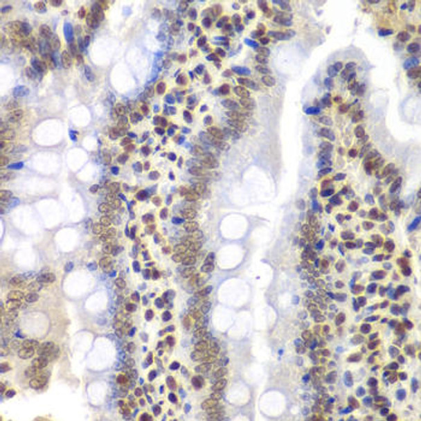 Anti-PSMC3 Antibody (CAB1986)