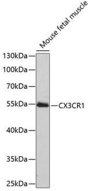 Anti-CX3CR1 Antibody (CAB2890)