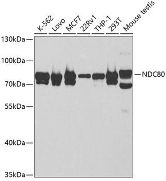 Anti-NDC80 Antibody (CAB5411)