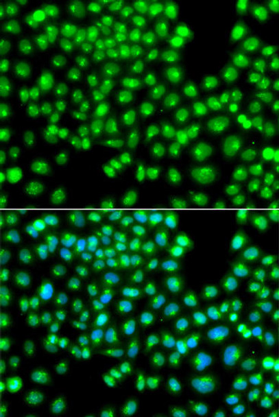 Anti-GOPC Antibody (CAB7513)