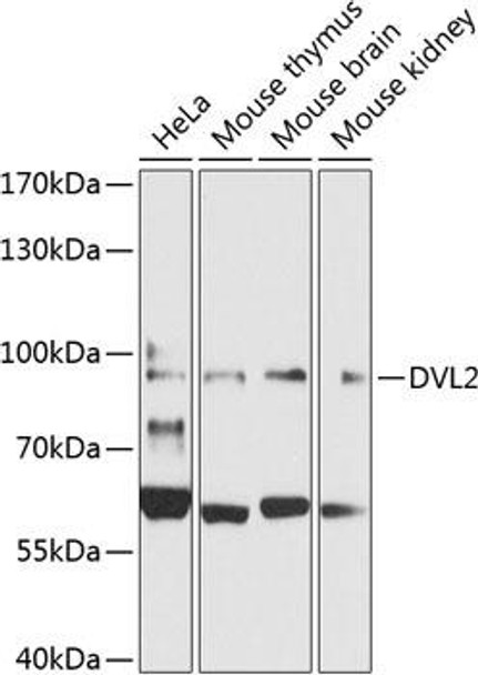 Anti-DVL2 Antibody (CAB7551)