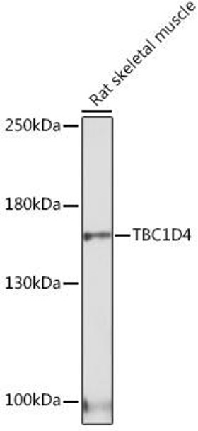 Anti-TBC1D4 Antibody (CAB18216)