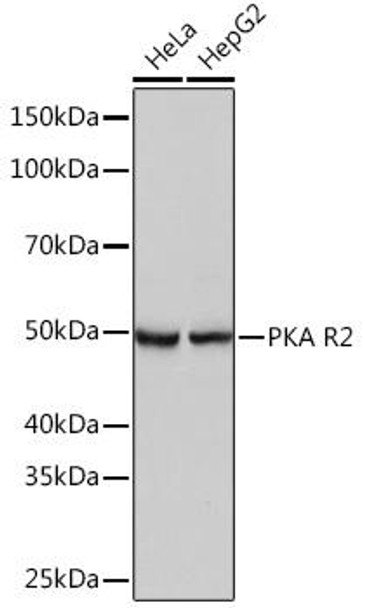 Anti-PKA R2 Antibody (CAB3889)