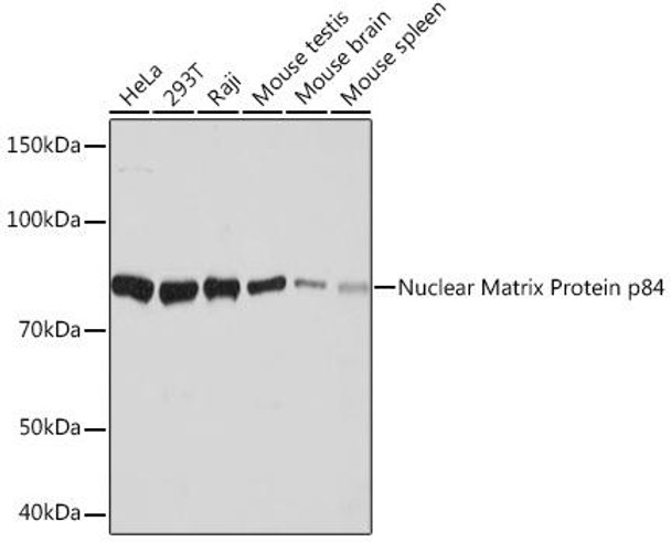 Anti-Nuclear Matrix Protein p84 Antibody (CAB9269)