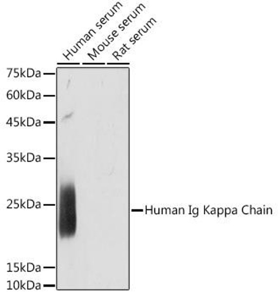 Anti-Human Ig Kappa Chain Antibody (CAB19720)