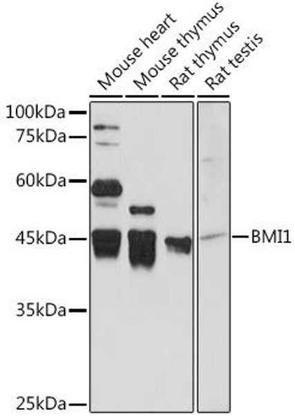 Anti-BMI1 Antibody (CAB0211)