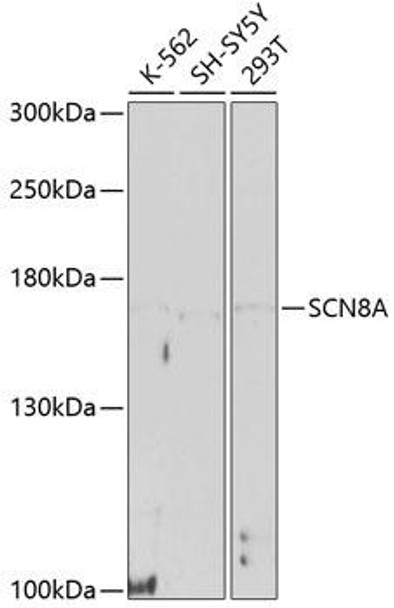 Anti-SCN8A Antibody (CAB10007)