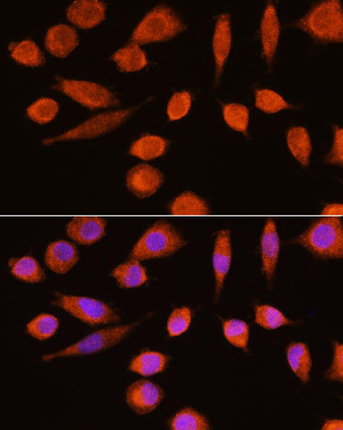 Anti-ENO2 Antibody (CAB12341)