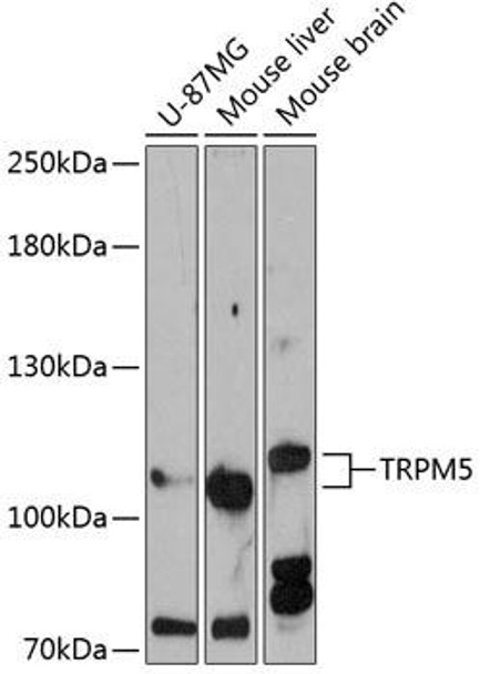 Anti-TRPM5 Antibody (CAB12365)