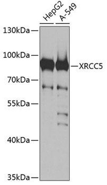 Anti-XRCC5 Antibody (CAB13369)