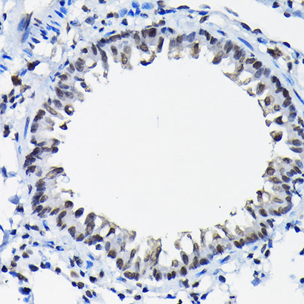 Anti-SSNA1 Antibody (CAB13377)