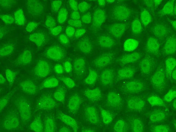 Anti-CXXC1 Antibody (CAB13423)