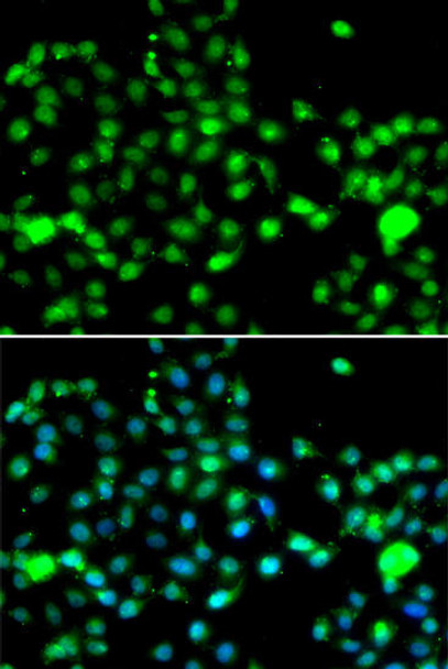 Anti-IP6K2 Antibody (CAB13427)