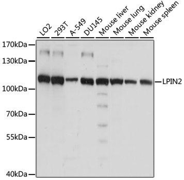 Anti-LPIN2 Antibody (CAB15762)