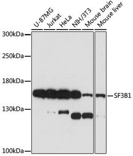 Anti-SF3B1 Antibody (CAB15801)