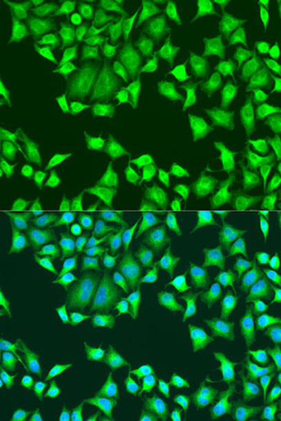 Anti-SH2D1B Antibody (CAB16010)