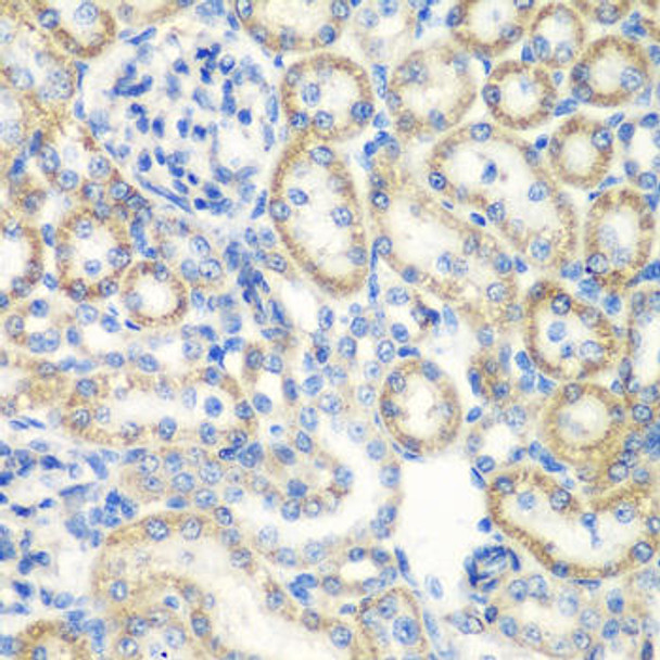 Anti-SMYD1 Antibody (CAB2340)