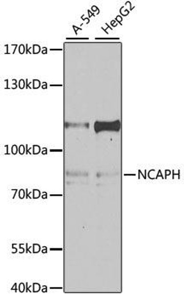 Anti-NCAPH Antibody (CAB4548)
