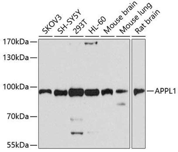 Anti-APPL1 Antibody (CAB4606)