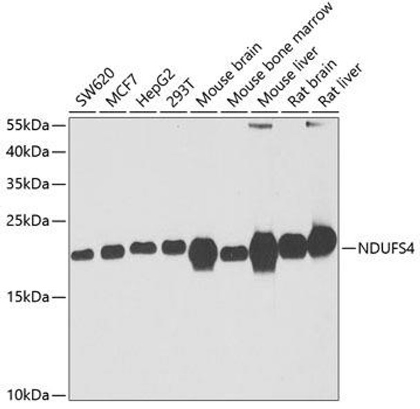 Anti-NDUFS4 Antibody (CAB6390)