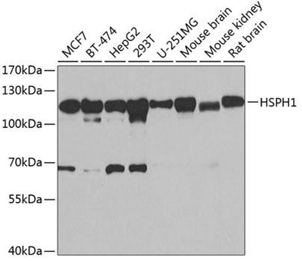 Anti-HSPH1 Antibody (CAB6622)
