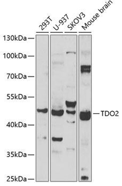 Anti-TDO2 Antibody (CAB6766)