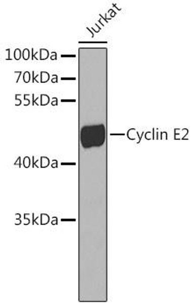Anti-Cyclin E2 Antibody (CAB7032)
