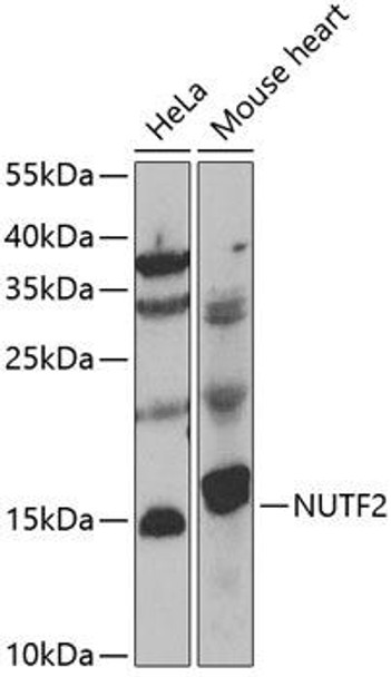 Anti-NUTF2 Antibody (CAB7057)