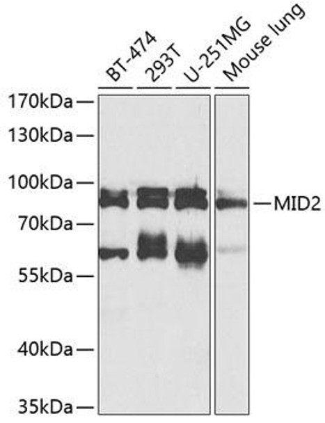 Anti-MID2 Antibody (CAB8325)