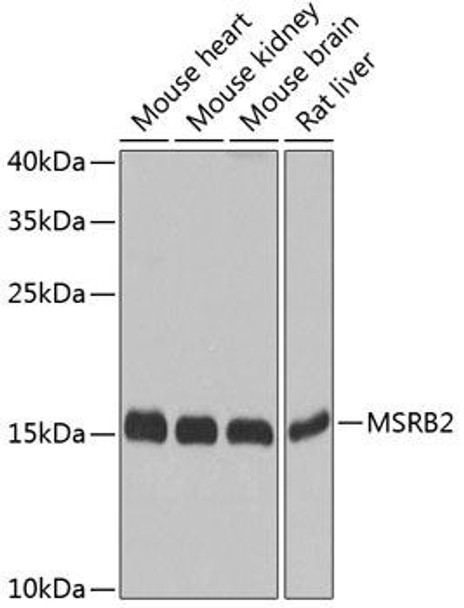 Anti-MSRB2 Antibody (CAB8364)