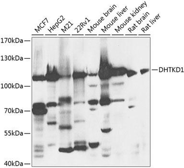 Anti-DHTKD1 Antibody (CAB8369)