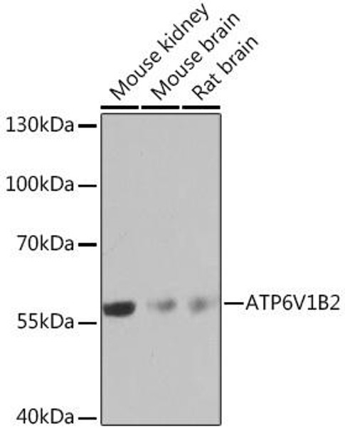 Anti-ATP6V1B2 Antibody (CAB16771)