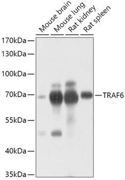 Anti-TRAF6 Antibody (CAB16991)