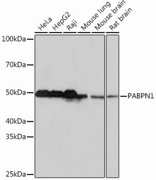 Anti-PABPN1 Antibody (CAB1735)