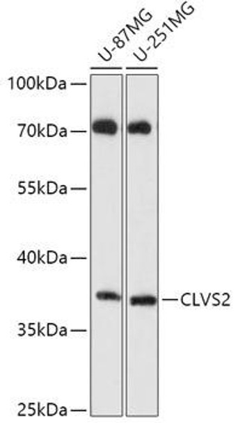 Anti-CLVS2 Antibody (CAB17826)