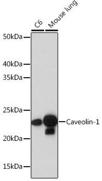 Anti-Caveolin-1 Antibody (CAB19006)