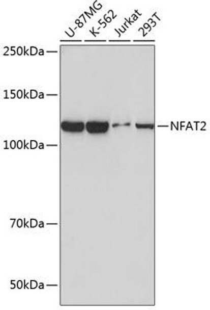 Anti-NFAT2 Antibody (CAB19597)